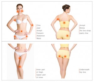 Liposuction Infographic