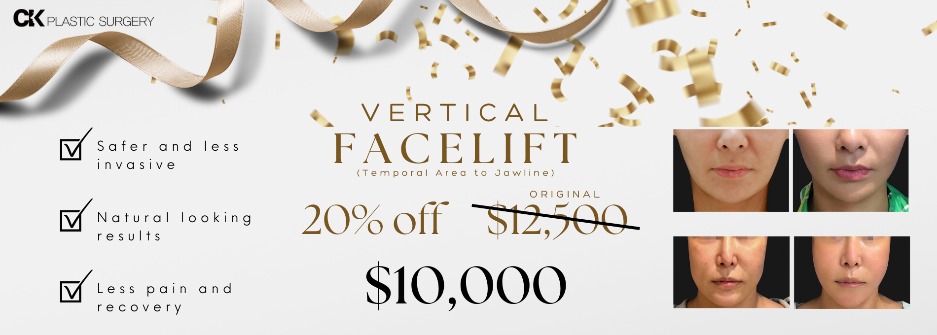 Vertical Facelift (11 × 17 in) (1900 × 680 px)